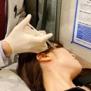 민연축산 | 달서구 구안와사 치료 병원 한의원, 얼굴 비대칭 남기고 싶지 않다면 &lt;필독&gt;