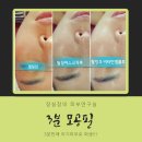 마쏘아로마 이미지
