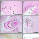아프리카메기 (Clarias gariepinus)의 직장 기생 선형동물 Paracamallanus cyathopharynx 이미지