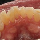 태장고려의원 네이버블로그