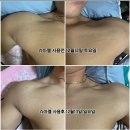 인셀덤 대구 이미지
