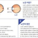 밝은누리안경 이미지