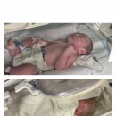 순천향대학병원 | 순천향대학병원 천안 / 일란성 쌍둥이 제왕절개 1일차 후기