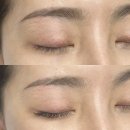 4147 | 대전 관저동속눈썹연장 블랙아이뷰티 천연 미세모 연장 후기