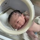 바다의제왕 | 부천서울여성병원에서 제왕절개 5박 6일 출산일기👶🏻