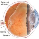 바른안과 이미지