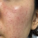 더붐의원 이미지