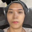 광주 김은영 피부관리샵 후기 ✨ 천연팩으로 탄력·보습·미백 한 번에!