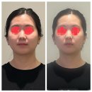 [광주 상무지구마사지 &#39;채움프리미엄스킨앤바디&#39;] 작은얼굴관리 후기