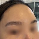 러블리의원 | 이너타이드 엑소좀 줄기세포앰플 프리미엄 홈케어 후기