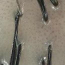 르칼피아 이미지