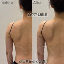 우아로랩 | 💕 부산 셀포랩우아로움 신부관리 바디조각 내돈내산 후기