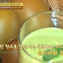 빅키위 이미지