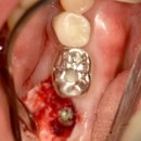 애플치과기공소 이미지