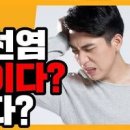 전립선염 증상 부터 원인 까지, 검사 치료 방법 정리 이미지