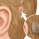 포낙보청기 서울역점 이미지