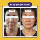 예쁜약손샵 이미지