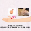 자연치유쑥뜸