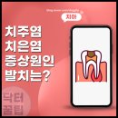 세정치과의원 | 용인 치과 만성 치주염 치은염 증상 원인과 발치 치료 방법 정리