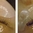 조은케어 이미지
