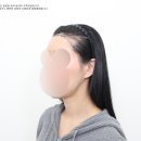 중앙헤어라인 티스토리