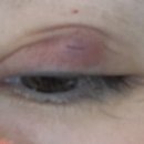 올바른안과의원 이미지