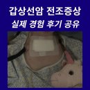 아시아방사선 | 갑상선암 전조증상, 진단 실제 후기 공유