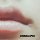 대교의료기 | [10월 마무리] 구각염(조커) 후기