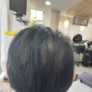 이삼칠 염색 두피관리