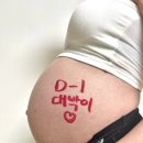 동백미즈산부인과의원 | [공지] 제왕절개 빨리 회복하는 법 + 흉터연고 추천 스카리젠 청아미즈산부인과 출산후기