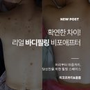 미코르뷰티 | [목동 바디필링]바디트러블 끝판왕! 등드름·각질·색소침착이 고민이라면?필링 시술 효과 공개✨
