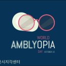 3427 | 0.2 양안약시 시지각훈련으로 1.0 회복했어요!