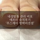 평택비전병원 | #246 평택 발톱 인그로운 베이직 관리 후기 / 평택 비전동 내성발톱 관리 푸스케어 평택비전점 솔직후기