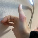준이비인후과의원 | 대방동 고이비인후과의원 진료 후기