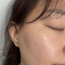 김포 기미 피부관리 비비드엘에서 맑아진 피부 톤 관리 후기