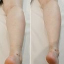 신부관리 효과 좋은 선에스테스파 분당점 후기