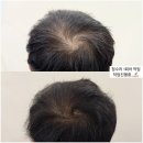 41190-01-07-113 | 서울 성수 두피문신 서울 성수 입술문신, 20년 경력 원장님이 직접 진행하는 라피네