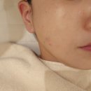 소담한의원 | 청주피부관리 고민 끝,소담에스테틱 청주피부관리실...채움 관리받고 촉촉한 피부에 만족한 솔직한 후기