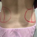 365리셋의원 이미지