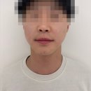 남자친구 | 불당동피부과에서 남자친구 텐쎄라 선물 내돈내산 후기