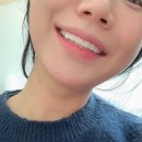 애프터기공소 | 신사역 라미네이트 메이크레이어 만족도 내 돈 내산 후기