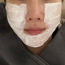 역적로1R-3 | 선릉역 쥬브아셀 효과, 후기, 가격, 통증