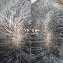 그로우모모 두피 탈모 케어센터 | 울산 두피문신 탈모 해결사 그로우모모