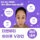 내서읍387 | [마산] 내서 피부관리 더앤뷰티- 탄력· V라인·윤곽· 리프팅 관리 하이푸 찐후기