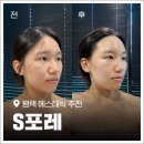 부용로55번길 | 평택 피부관리 추천 밀도부터 다른 'S포레' 알테온 시그니처 케어 후기