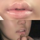 조앤박의원 | 강남 조앤박 입술반영구후기