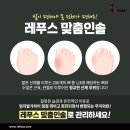 레푸스n바바 이미지