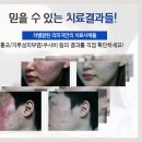 나아짐 이미지