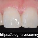 연희세브란스치과의원 이미지