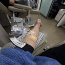 스마트 | 대구 누네안과 스마트라식 후기